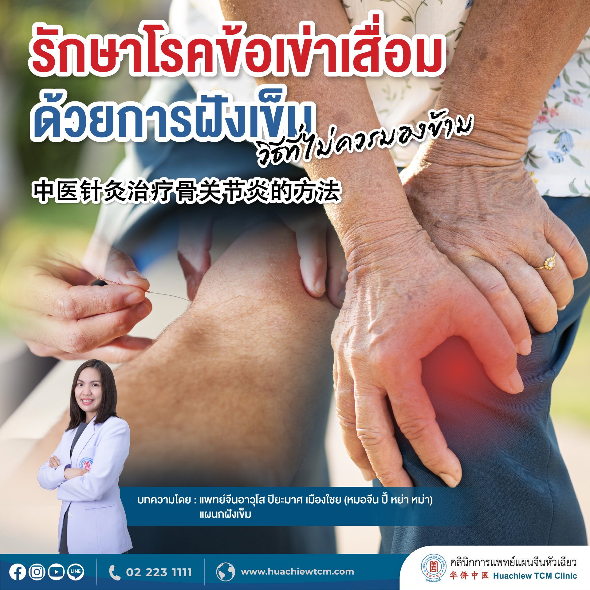 รักษาโรคข้อเข่าเสื่อมด้วยการฝังเข็ม วิธีที่ไม่ควรมองข้าม  รักษาโรคข้อเข่าเสื่อมด้วยการฝังเข็ม วิธีที่ไม่ควรมองข้าม