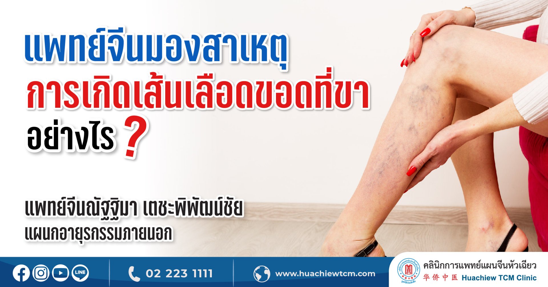 แพทย์จีนมองสาเหตุการเกิดเส้นเลือดขอดที่ขาอย่างไร แพทย์จีนมองสาเหตุการเกิดเส้นเลือดขอดที่ขาอย่างไร