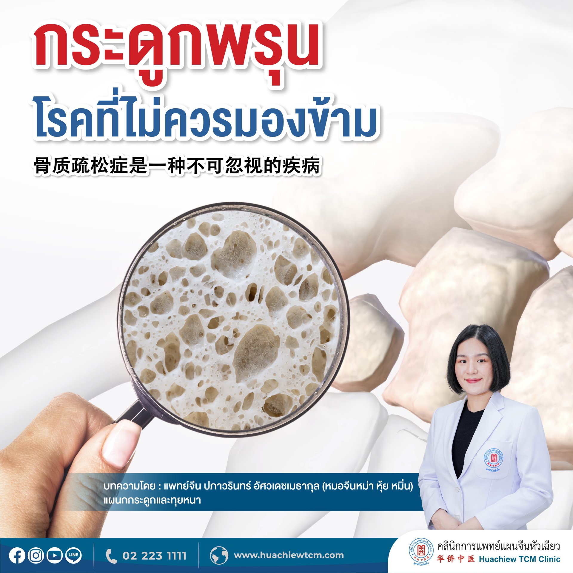 กระดูกพรุน.....โรคที่ไม่ควรมองข้าม กระดูกพรุน.....โรคที่ไม่ควรมองข้าม