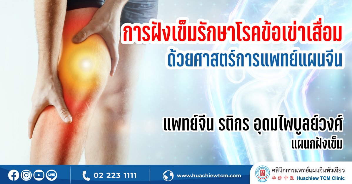 การฝังเข็มรักษาโรคข้อเข่าเสื่อมด้วยศาสตร์การแพทย์แผนจีน การฝังเข็มรักษาโรคข้อเข่าเสื่อมด้วยศาสตร์การแพทย์แผนจีน
