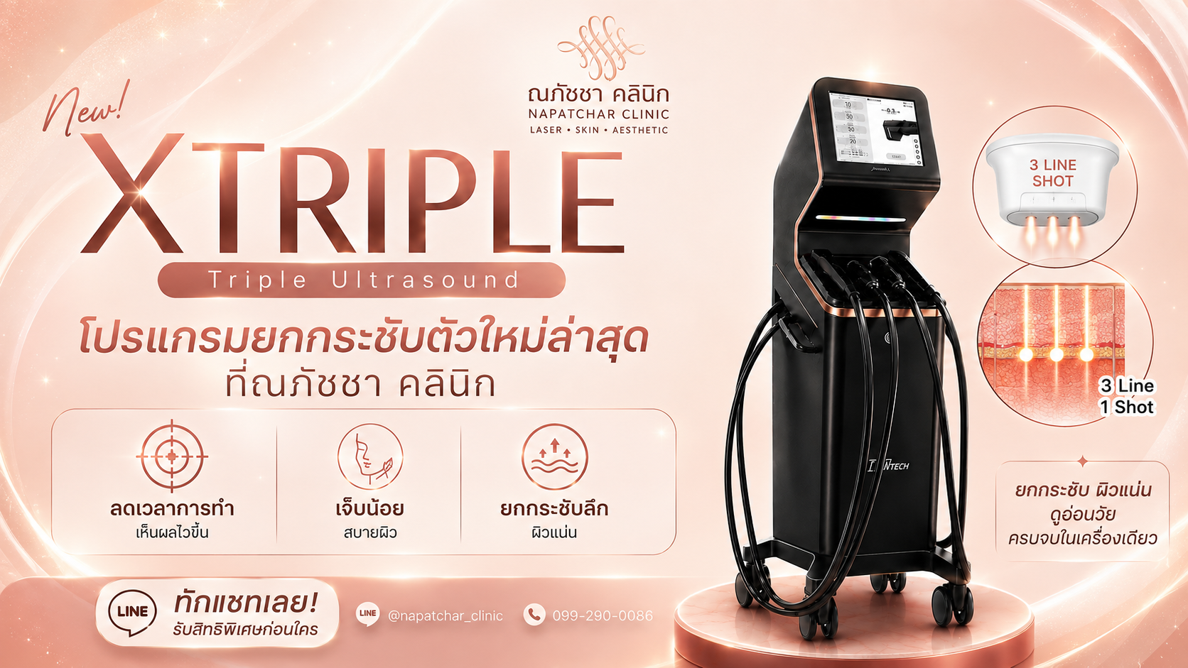 XTRIPLE Phuket ยกกระชับหน้า 3 Lines ใน 1 Shot | ณภัชชาคลินิก ภูเก็ต