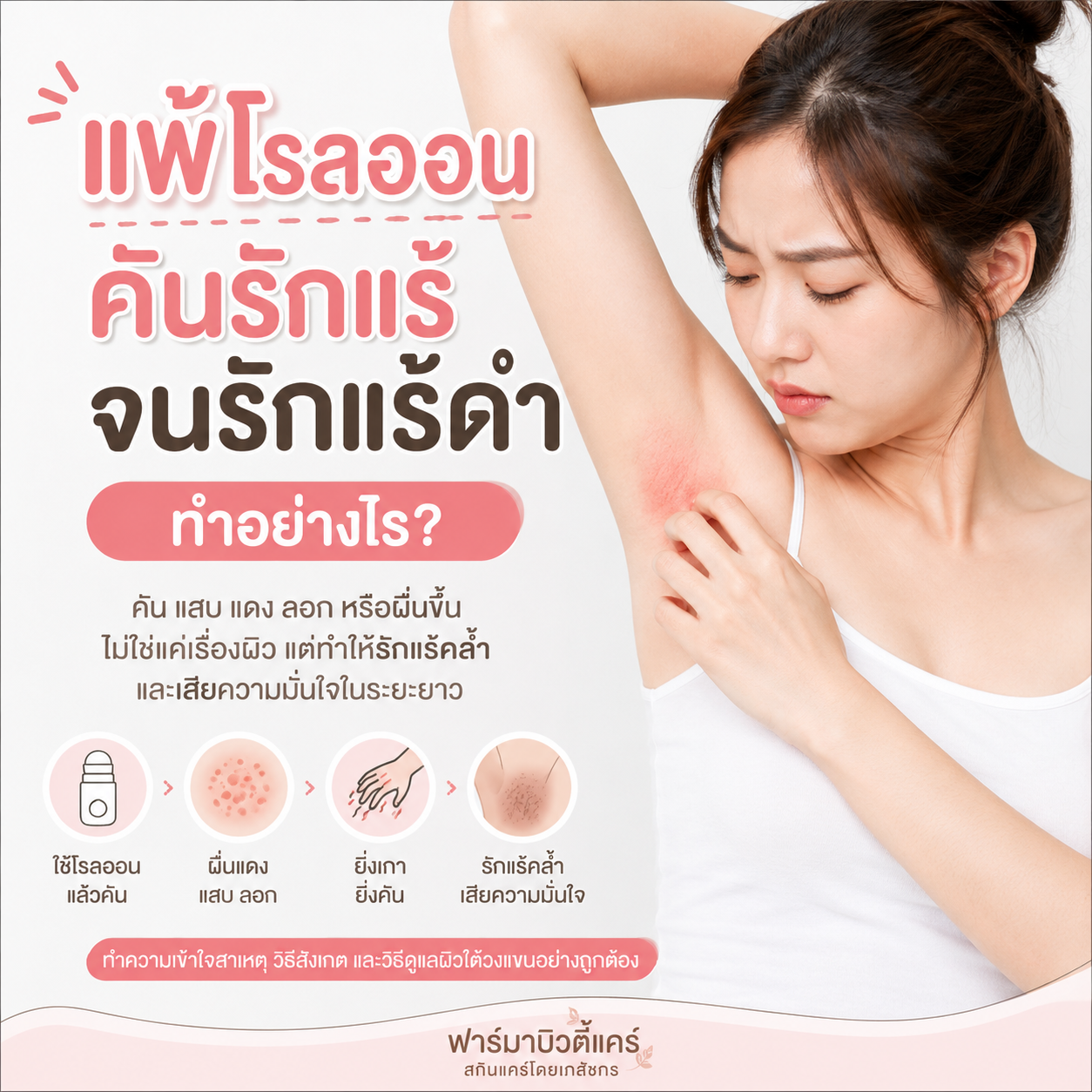 แพ้โรลออน คันรักแร้ จนรักแร้ดำ  ทำไงดี ? บทความโดยเภสัชกร