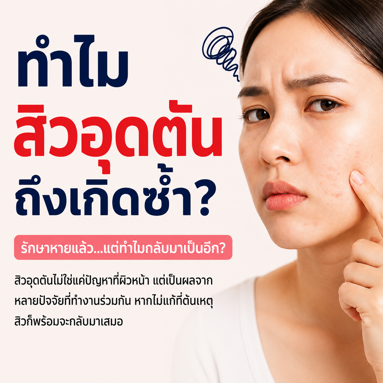 ทำไมสิวอุดตันถึงเกิดซ้ำ? รู้สาเหตุที่แท้จริง แล้วแก้ให้ตรงจุด