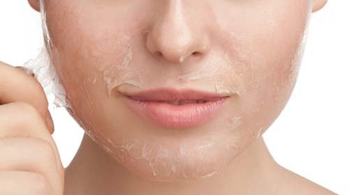 ลอกผิวขาว อย่าหาทำนะ อันตรายมาก ลอกผิวขาว อย่าหาทำนะ อันตรายมาก