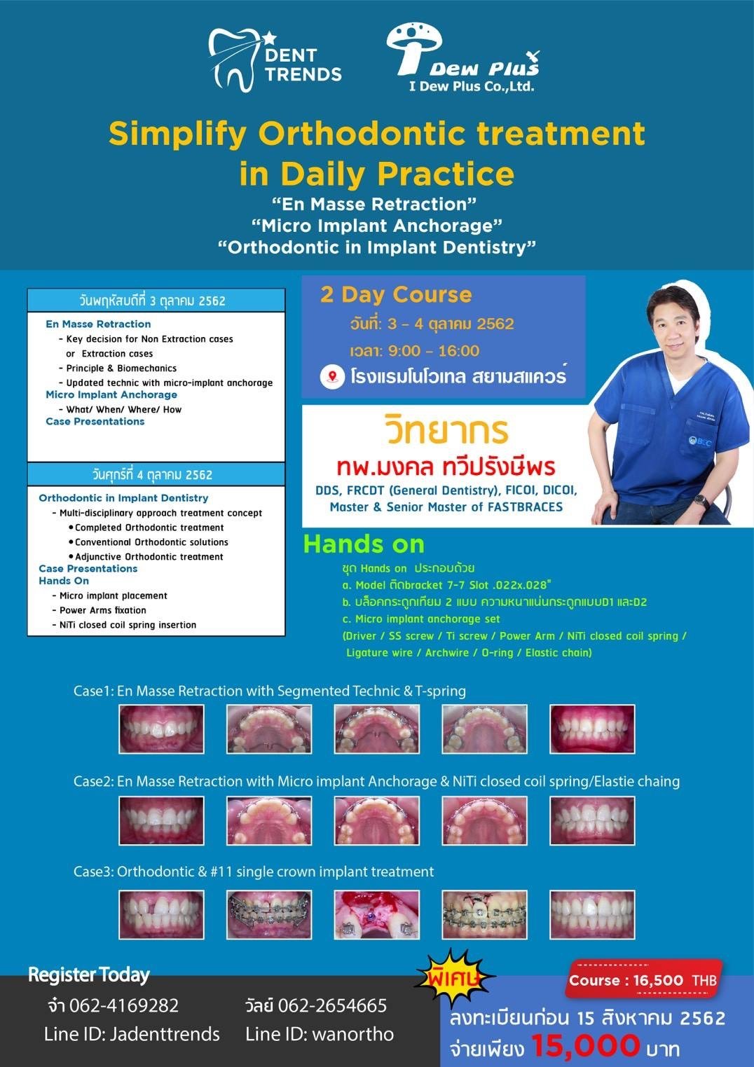 Simplify Orthodontic treatment in Daily Practice
