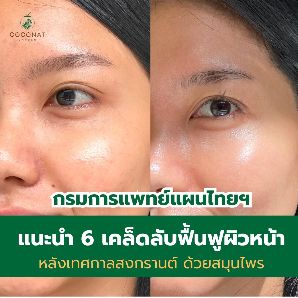 6 เคล็ดลับ ฟื้นฟูผิวหน้า ผิวพรรณ หลังเทศกาลสงกรานต์ ด้วยสมุนไพร ช่วยให้ผิวหน้า ผิวพรรณ กลับมาเนียนใส  6 เคล็ดลับ ฟื้นฟูผิวหน้า ผิวพรรณ หลังเทศกาลสงกรานต์ ด้วยสมุนไพร ช่วยให้ผิวหน้า ผิวพรรณ กลับมาเนียนใส