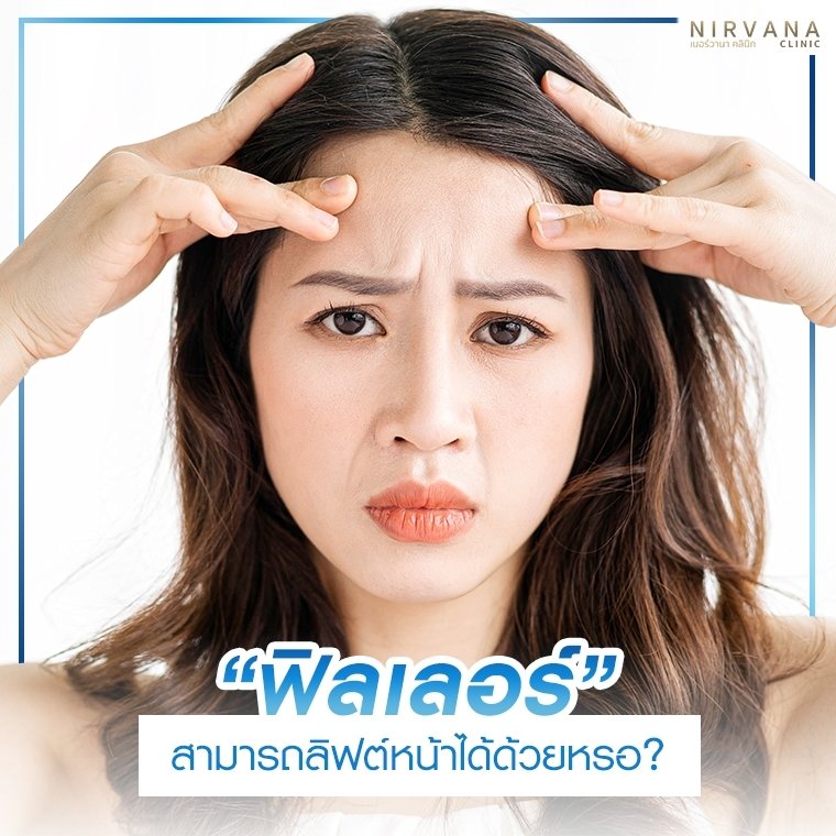 ฟิลเลอร์สามารถลิฟต์หน้าได้ด้วยหรอ?