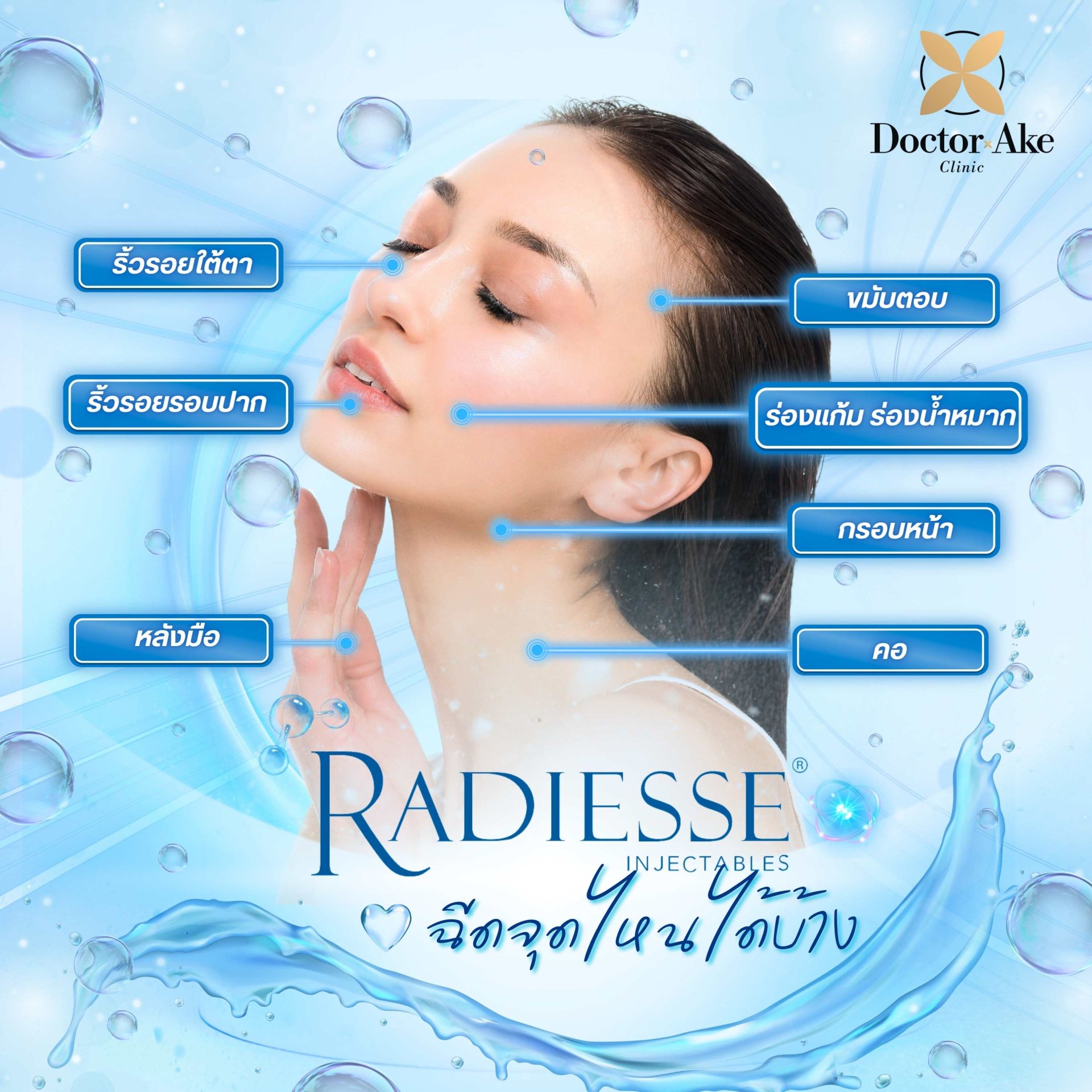 โปรแกรมฉีดRadiesse
