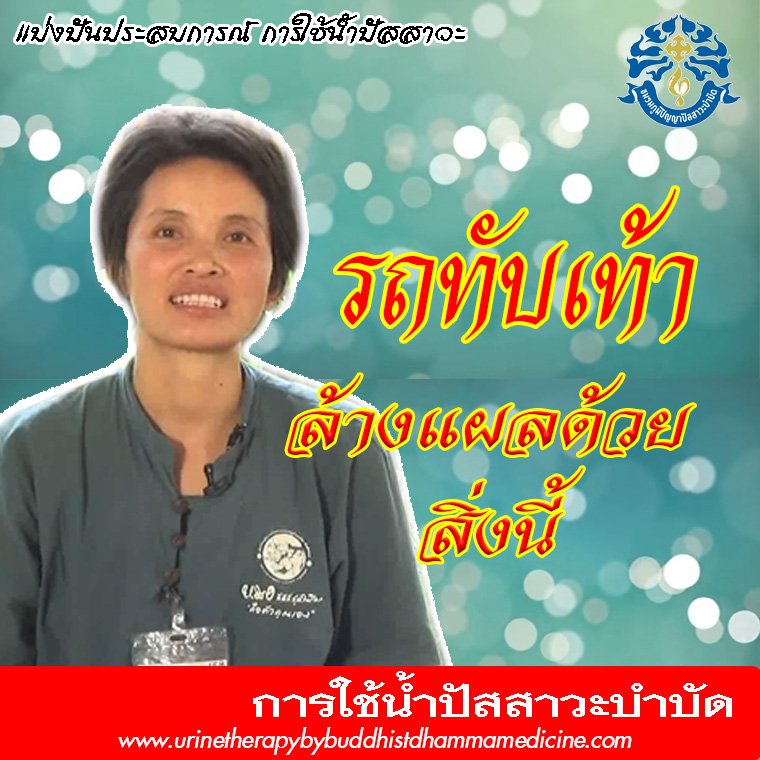 ล้างแผลด้วย น้ำปัสสาวะบำบัด ล้างแผลด้วย น้ำปัสสาวะบำบัด