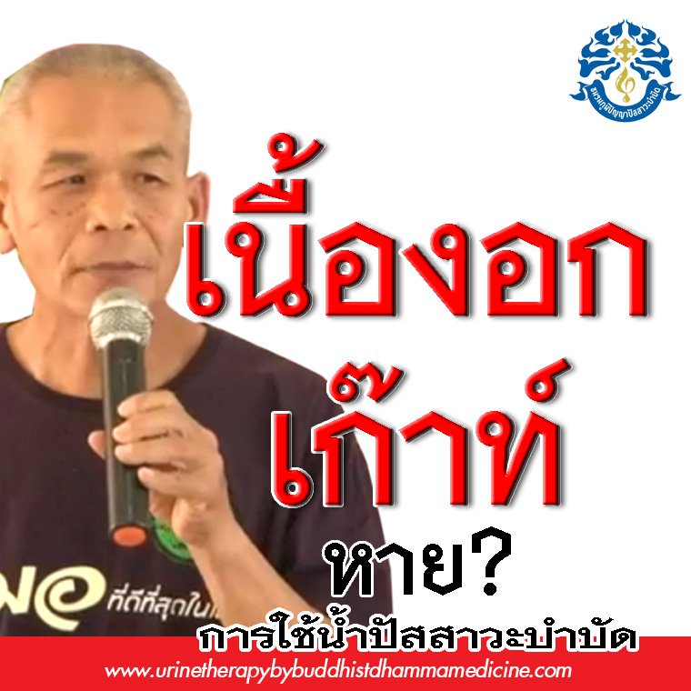 เนื้องอก เก๊าท์ หายด้วยสิ่งนี้ เนื้องอก เก๊าท์ หายด้วยสิ่งนี้