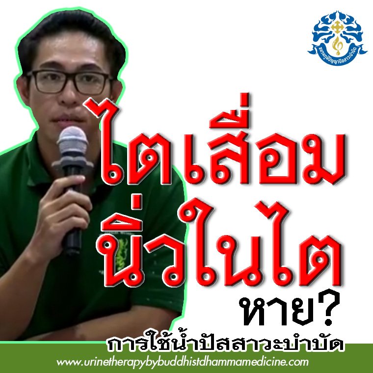 โรคไตเสื่อม ระยะ 4 นิ่วในไต รักษาด้วยวิธีง่ายๆ โรคไตเสื่อม ระยะ 4 นิ่วในไต รักษาด้วยวิธีง่ายๆ