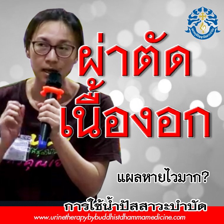 ผ่าตัด เนื้อ งอก ผ่าตัด เนื้อ งอก