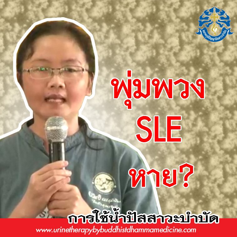 โรค SLEหรือโรคพุ่มพวง