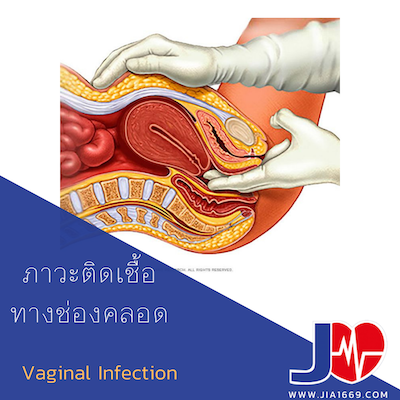 ภาวะติดเชื้อทางช่องคลอด  ภาวะติดเชื้อทางช่องคลอด