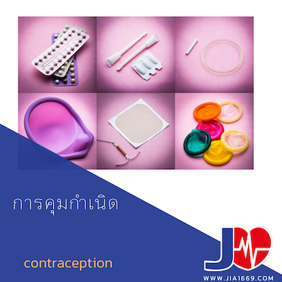 contraception contraception