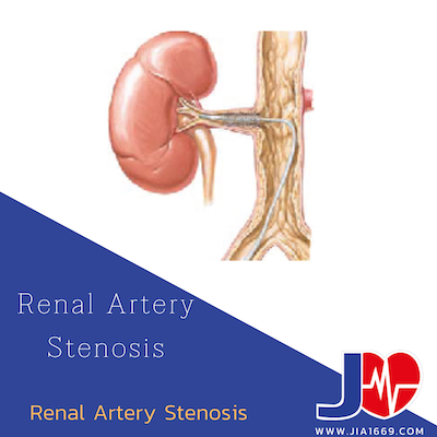 Renal Artery Stenosis Renal Artery Stenosis