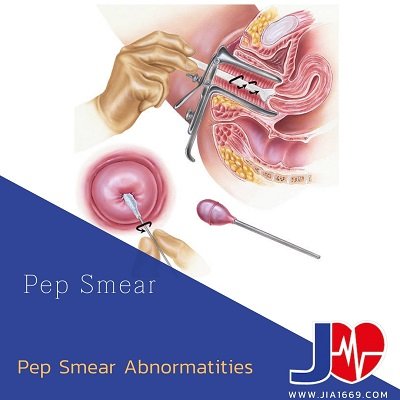 Pap Smear Abnormalities Pap Smear Abnormalities