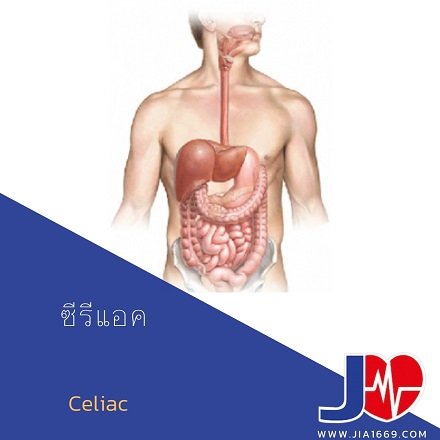 โรคซีรีแอค โรคซีรีแอค