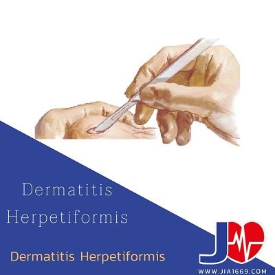 Dermatitis herpetiformis  Dermatitis herpetiformis