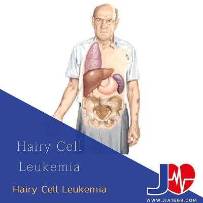Hairy Cell Leukemia Hairy Cell Leukemia