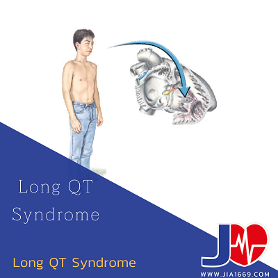 Long QT Syndrome Long QT Syndrome