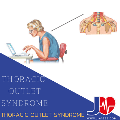 THORACIC OUTLET SYNDROME THORACIC OUTLET SYNDROME