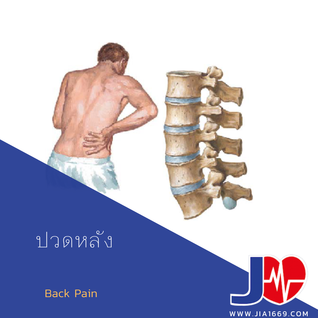 ปวดหลัง ปวดหลัง