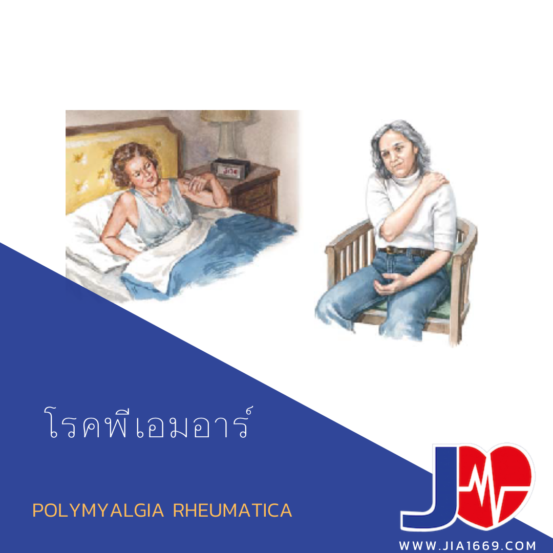 โรคพีเอมอาร์ โรคพีเอมอาร์