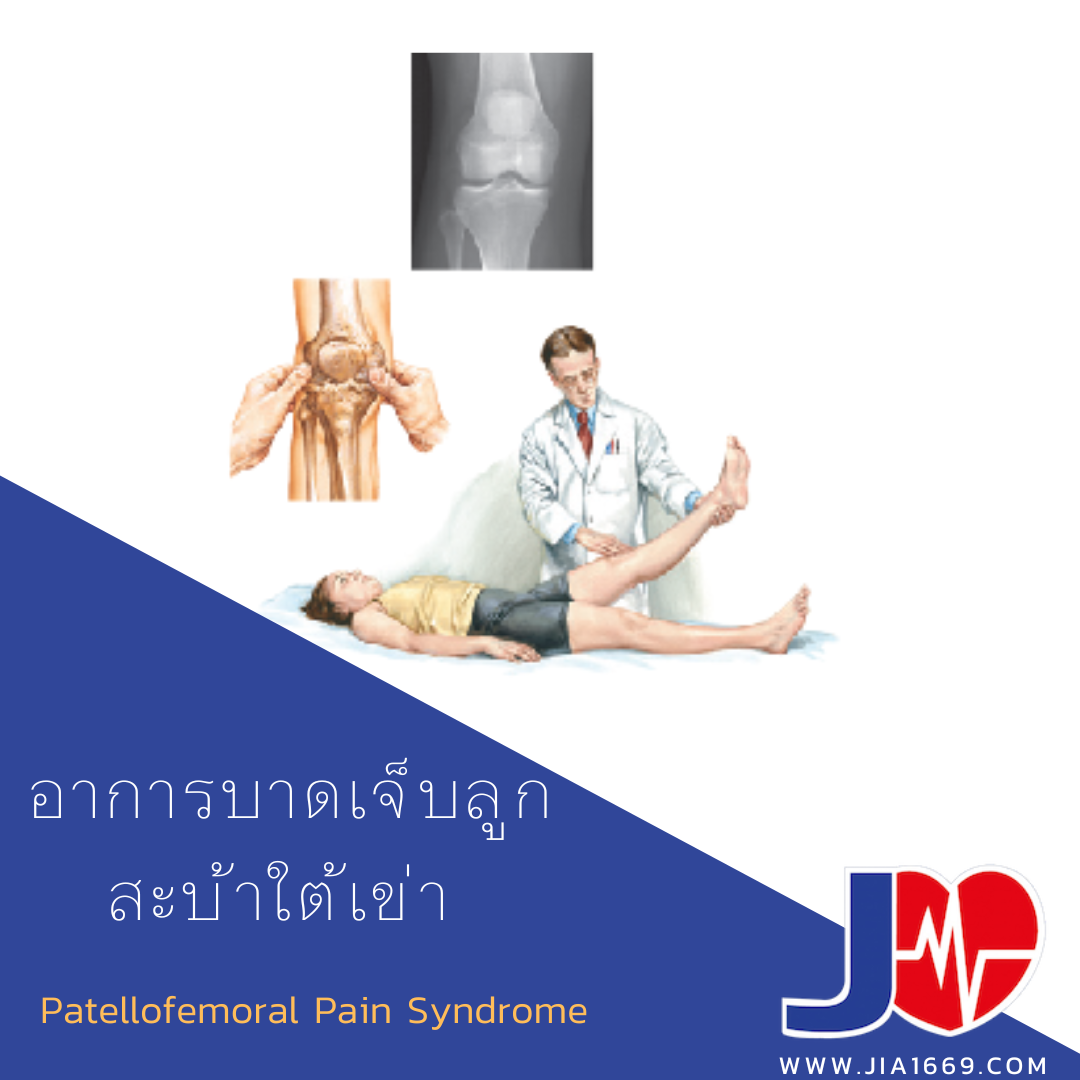 อาการบาดเจ็บลูกสะบ้าใต้เข่า อาการบาดเจ็บลูกสะบ้าใต้เข่า