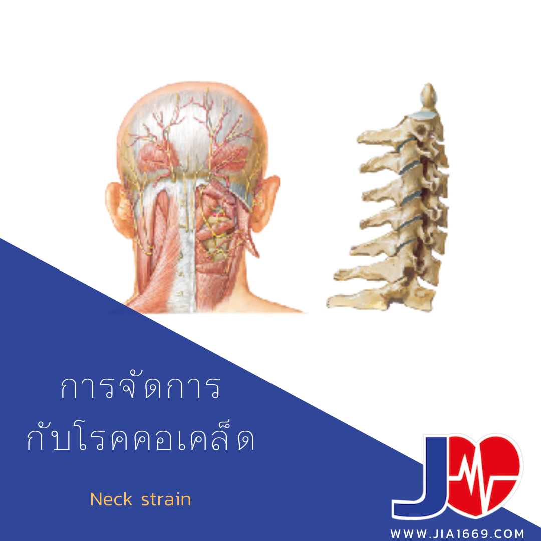 การจัดการกับโรคคอเคล็ด การจัดการกับโรคคอเคล็ด