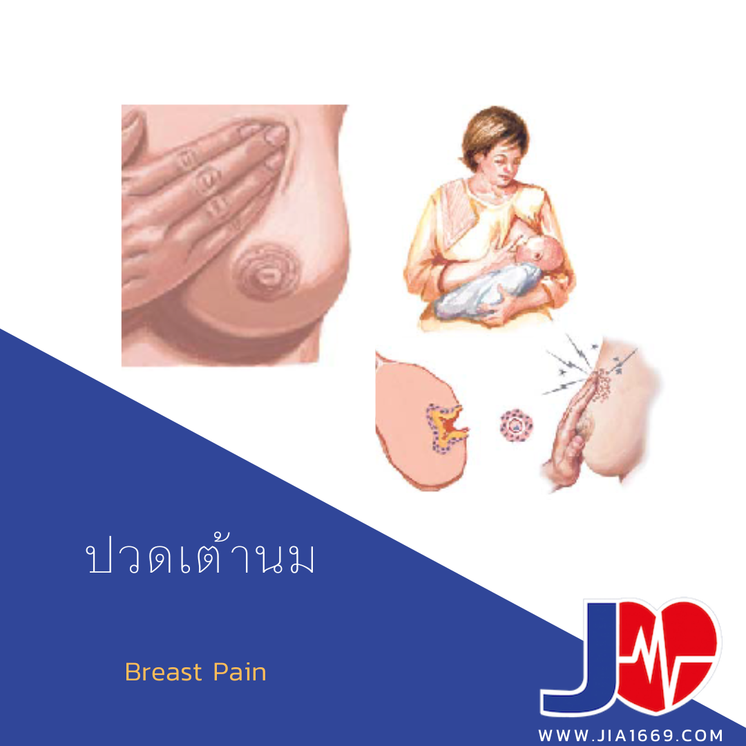 Breast Pain 