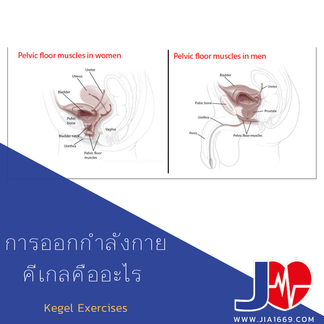 การออกกำลังกายคีเกลคืออะไร การออกกำลังกายคีเกลคืออะไร