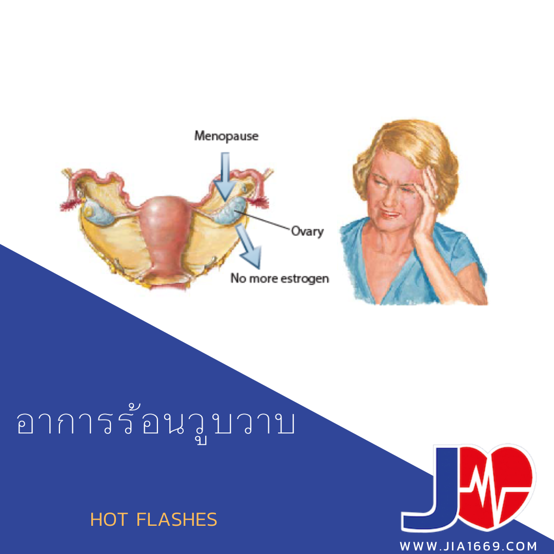 อาการร้อนวูบวาบ อาการร้อนวูบวาบ
