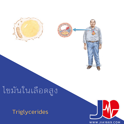 ไขมันในเลือดสูง ไขมันในเลือดสูง