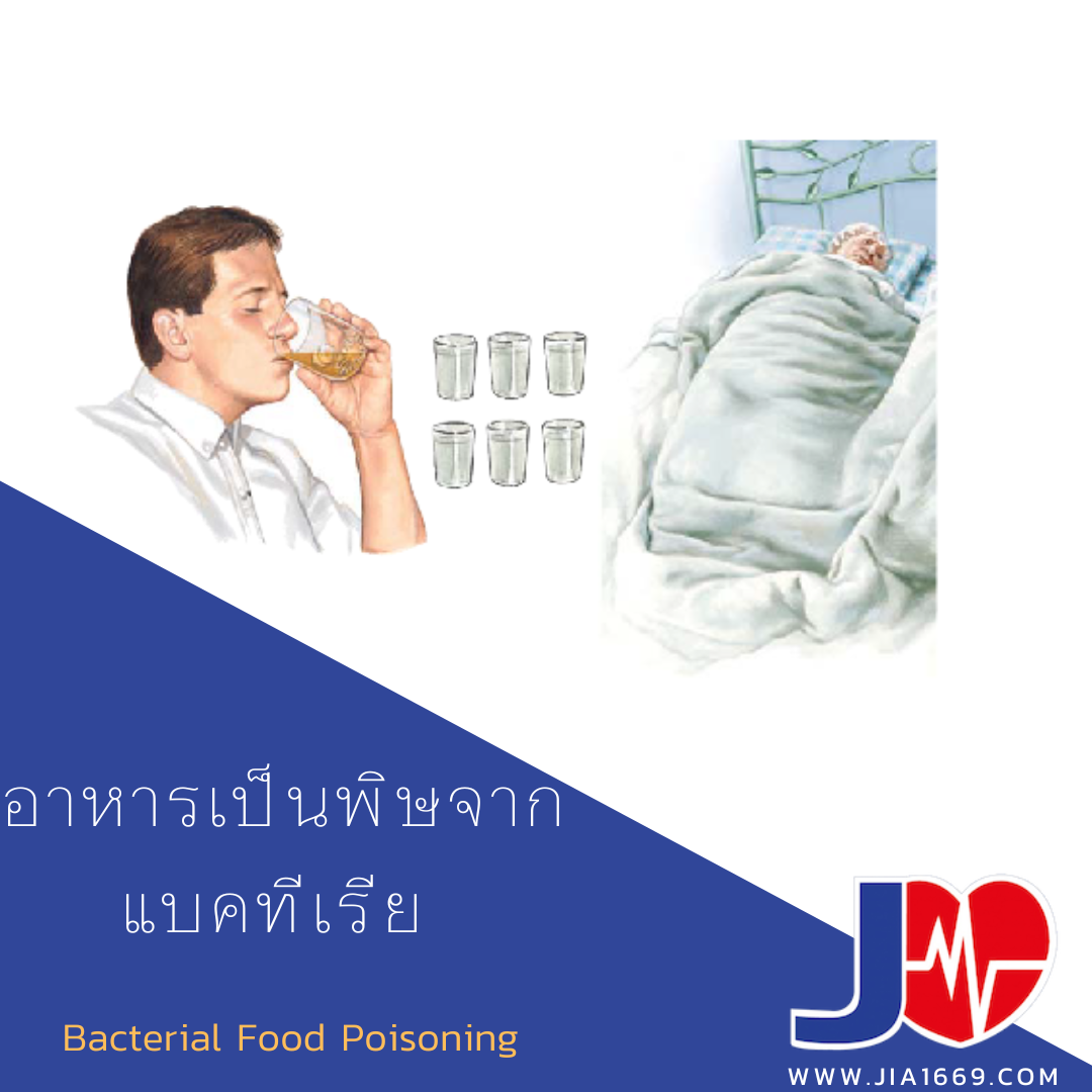 Bacterial Food Poisoning 