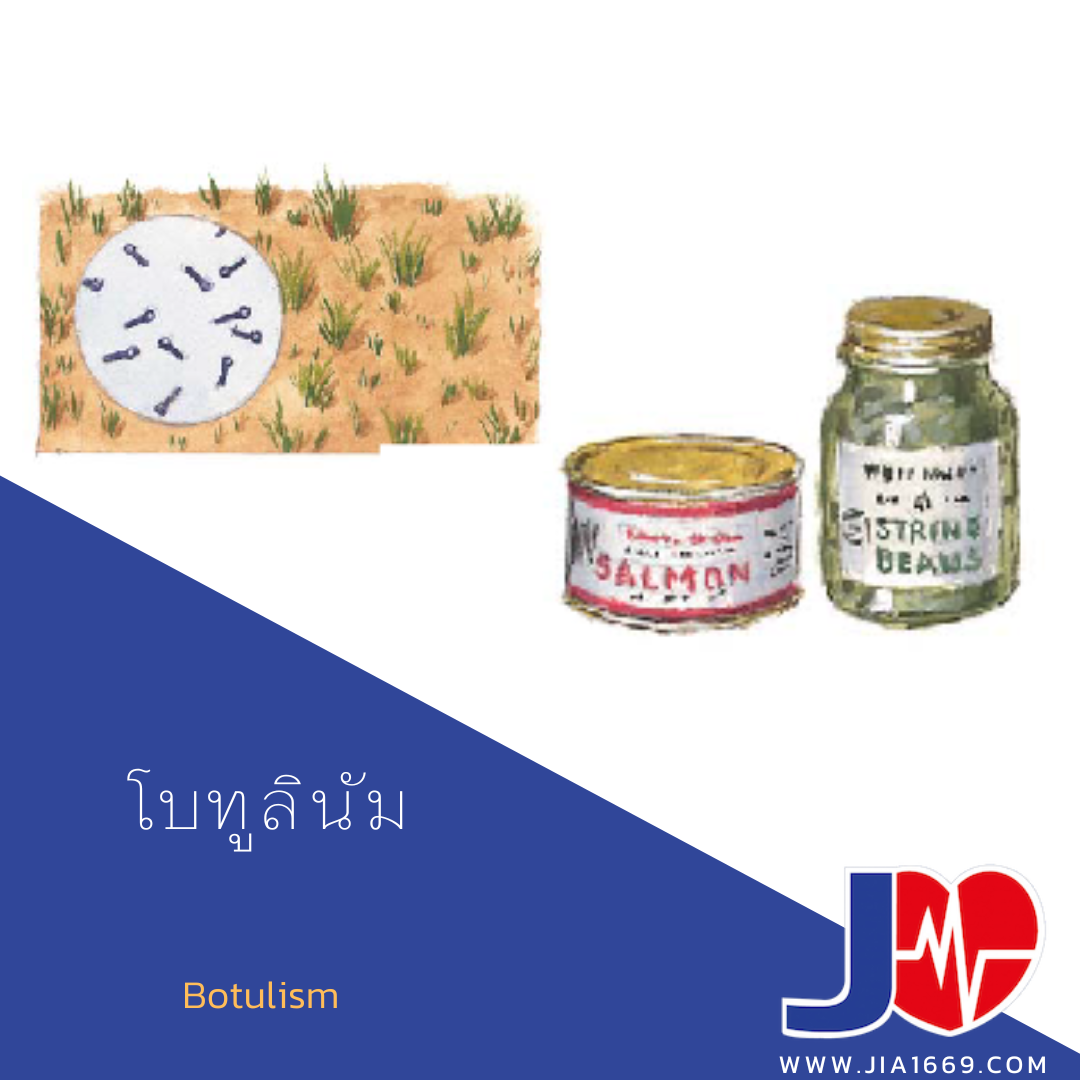 โบทูลินัม โบทูลินัม
