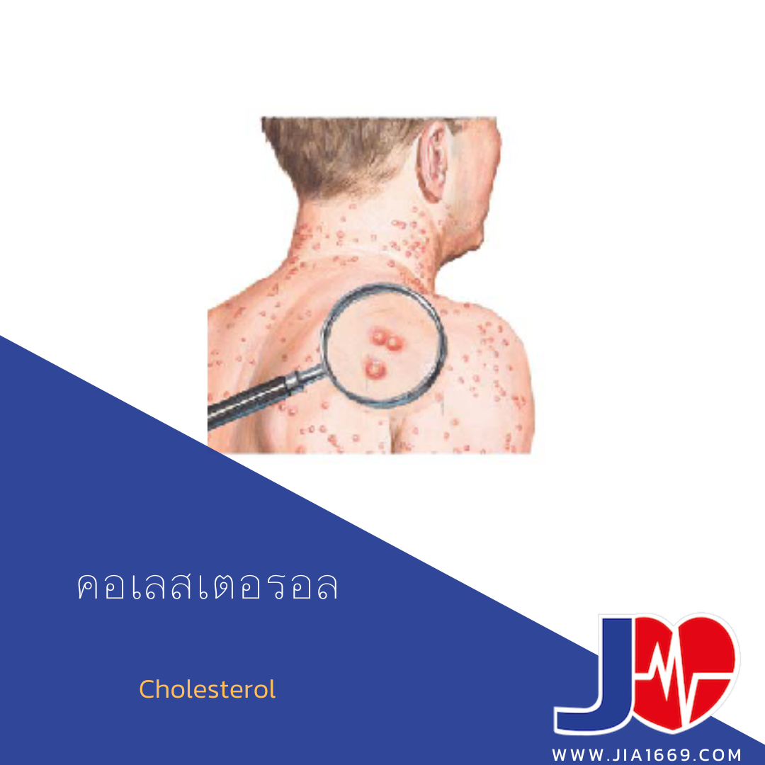 คอเลสเตอรอล คอเลสเตอรอล