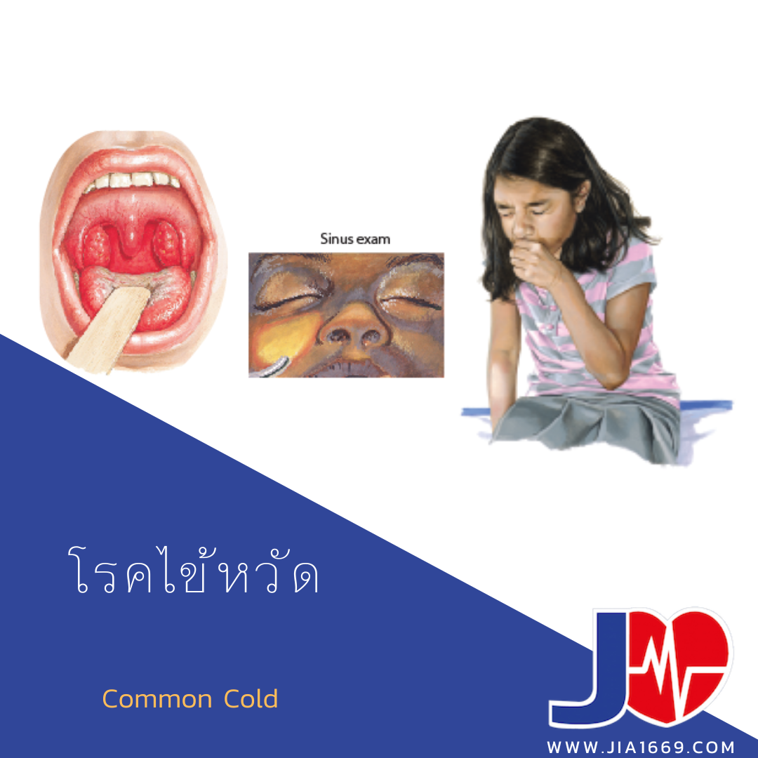 โรคไข้หวัด โรคไข้หวัด