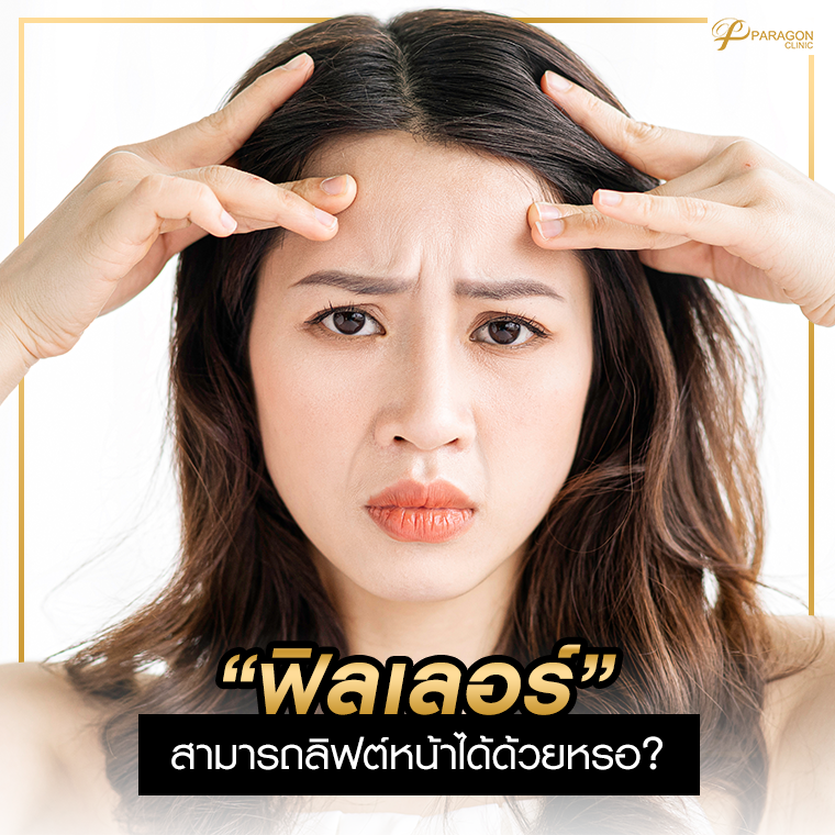 ฟิลเลอร์สามารถลิฟต์หน้าได้ด้วยหรอ? 