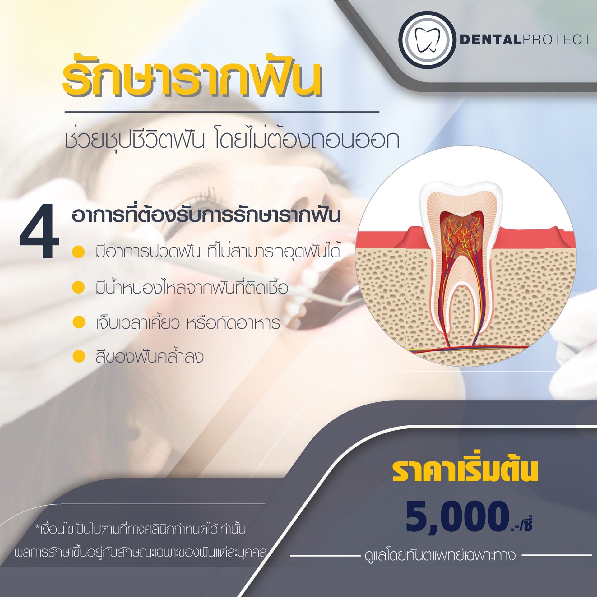 หมอครับฟันผุแล้วเริ่มปวด แค่อุดฟันได้มั้ย ? 