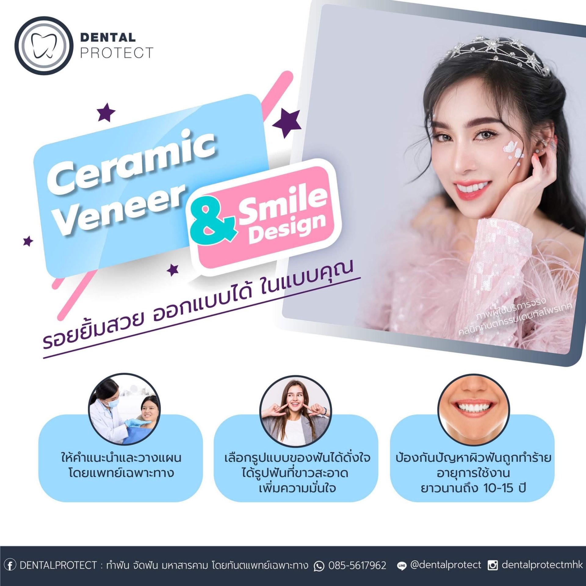 รอยยิ้มสวย ออกแบบได้ ในสไตล์คุณ ด้วย Ceramic Veneer 