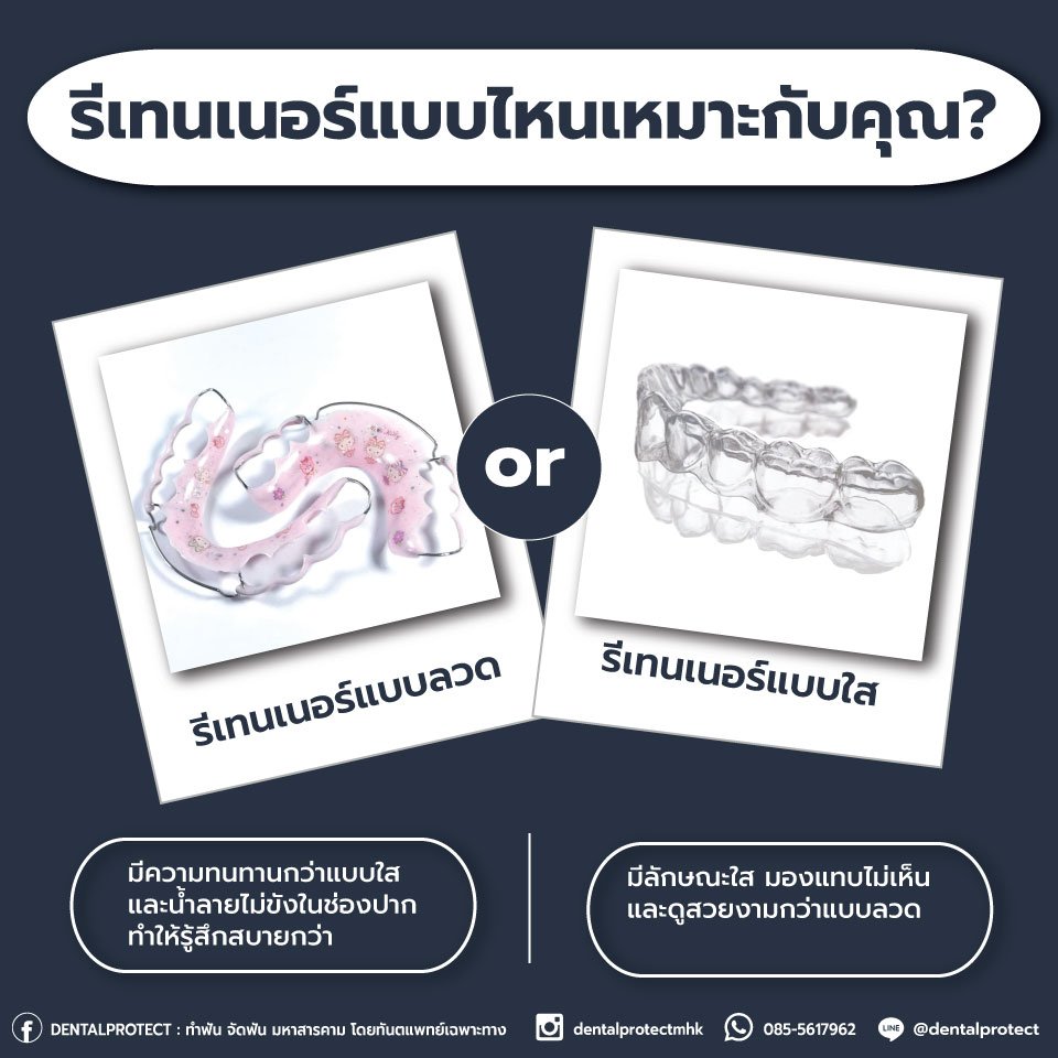 รีเทนเนอร์แบบไหนเหมาะกับคุณ?