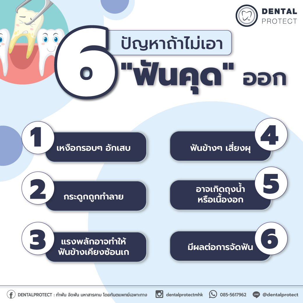 6 ปัญหา ถ้าไม่เอาฟันคุดออก 