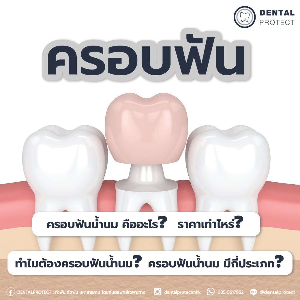 ครอบฟันน้ำนม คืออะไร? 