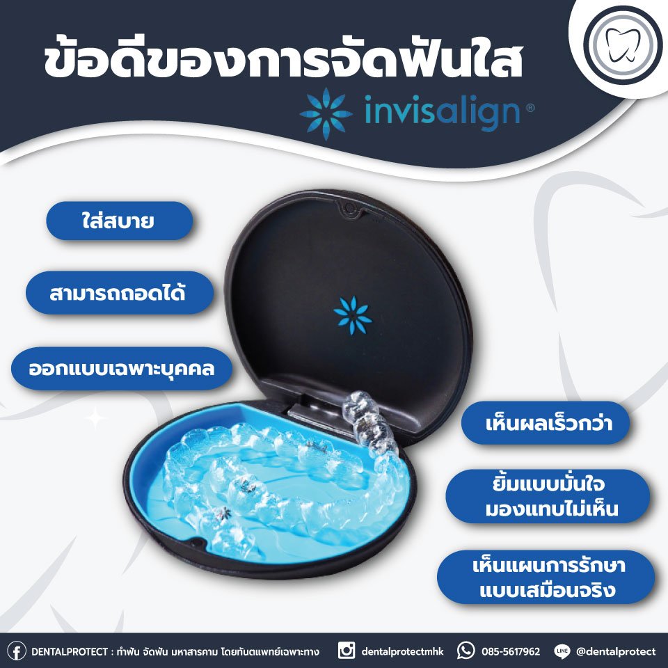 ข้อดีของการจัดฟันใส Invisalign 