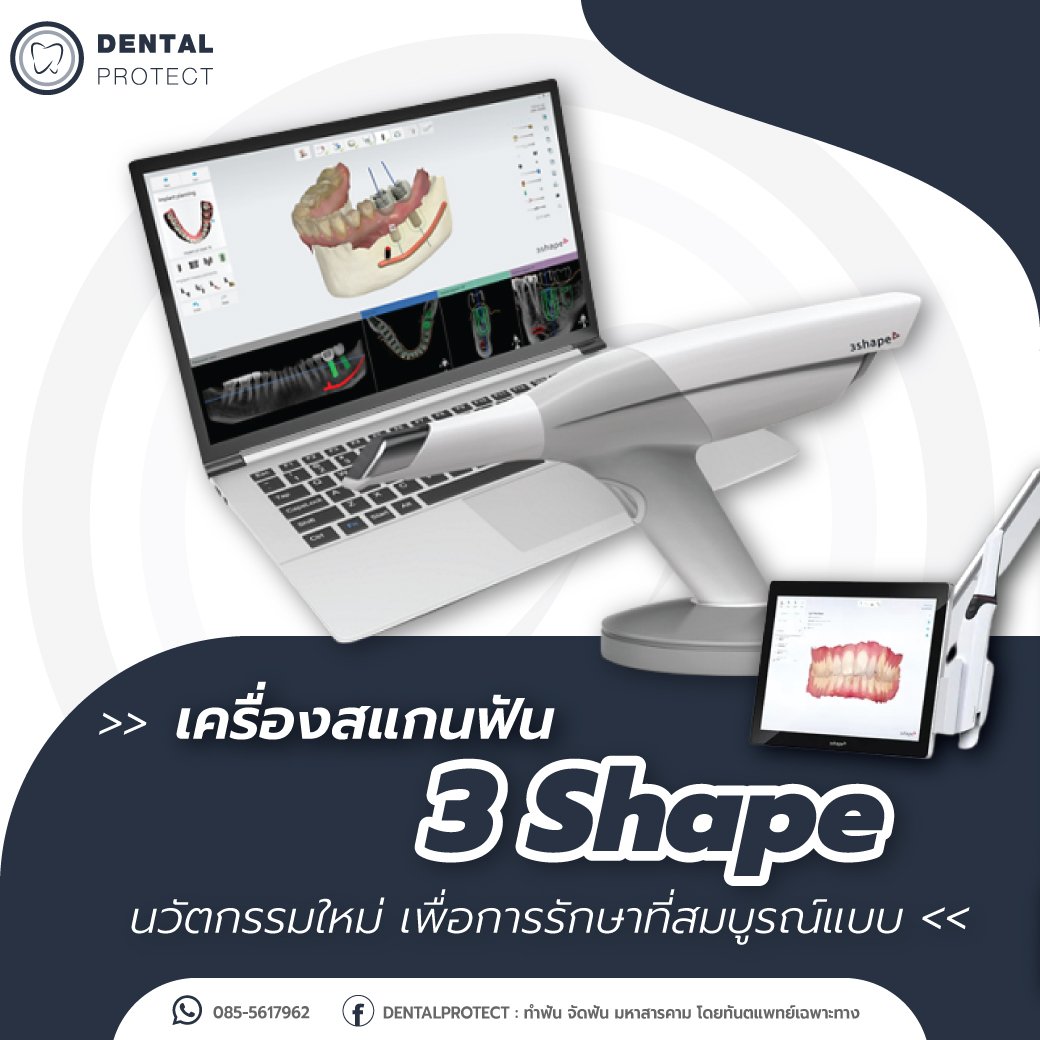 เครื่องสแกนฟัน 3Shape เพื่อการรักษาที่สมบูรณ์แบบ