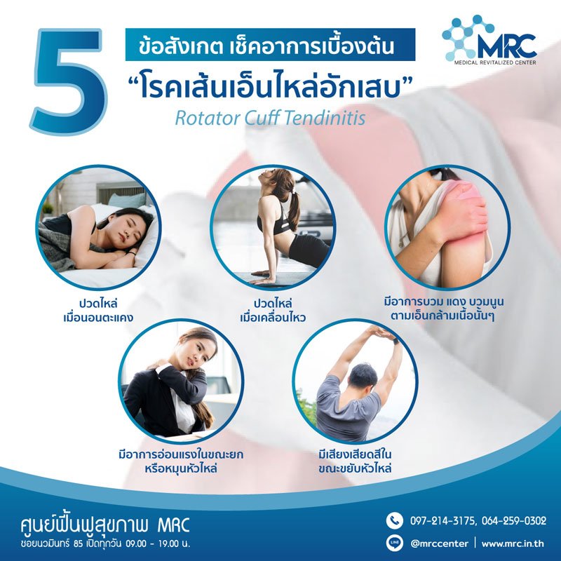 รักษาอาการ เส้นเอ็นไหล่อักเสบ รักษาอาการ เส้นเอ็นไหล่อักเสบ