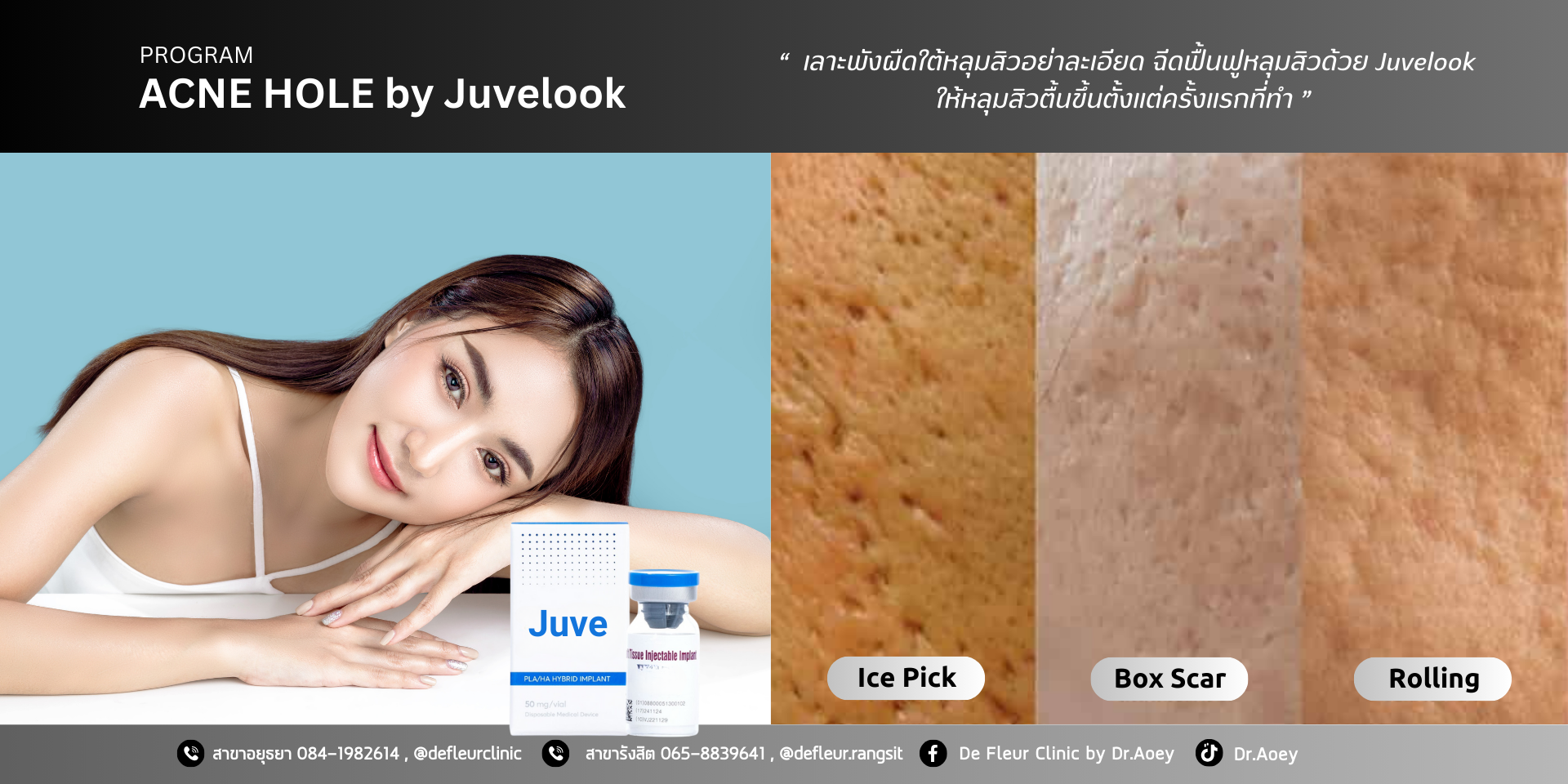 JuveLook ไหมน้ำตัวใหม่ ไฮบริท Biostimulator ที่มาแรงที่สุดในตอนนี้