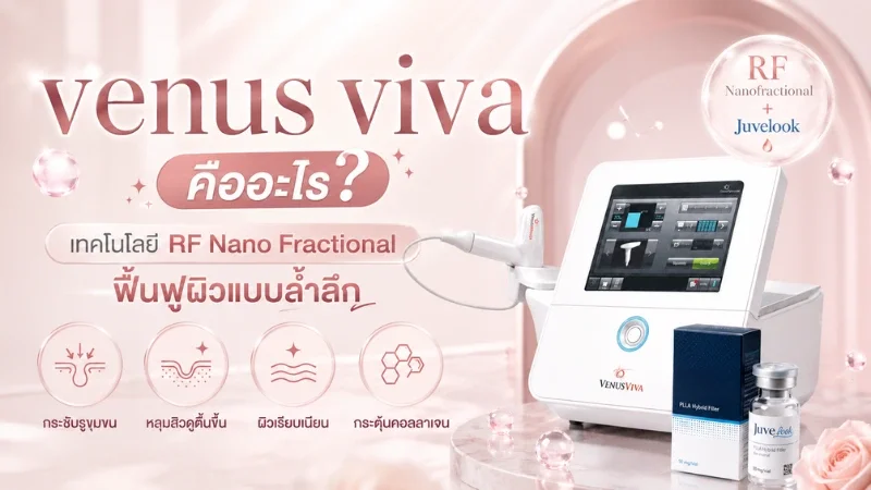 venus viva คือ
