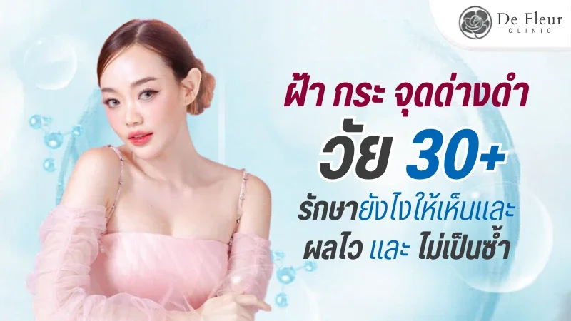 รักษาฝ้ากระ